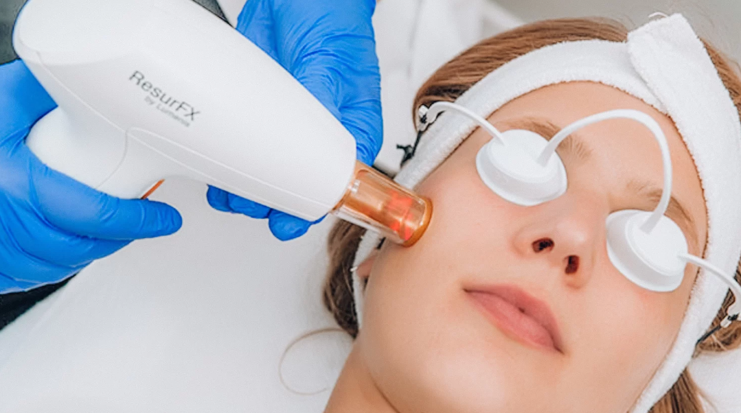 Fractional Laser Resurfacing in Jaipur
